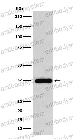 Anti-FBP1 Antibody (R1M07)