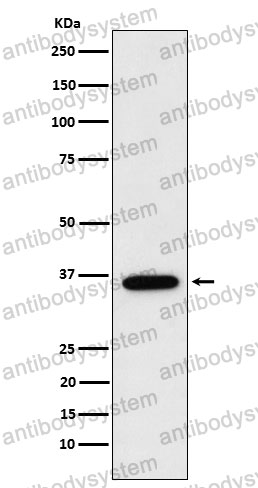 Anti-FBP1 Antibody (R1M06)
