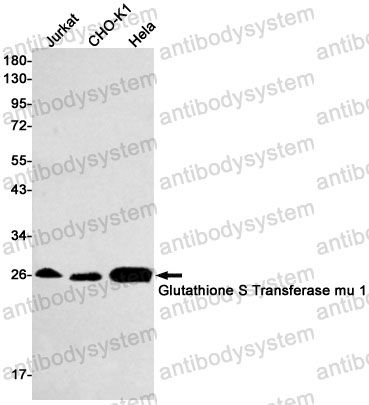 Anti-GSTM1 Antibody (R1M08)