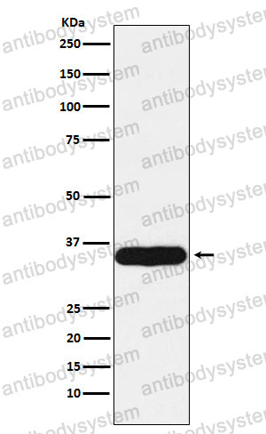 Anti-TPM1 Antibody (R1M09)