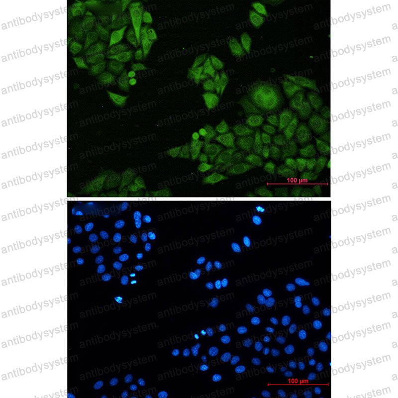 Anti-ANXA4 Antibody (R1M11)