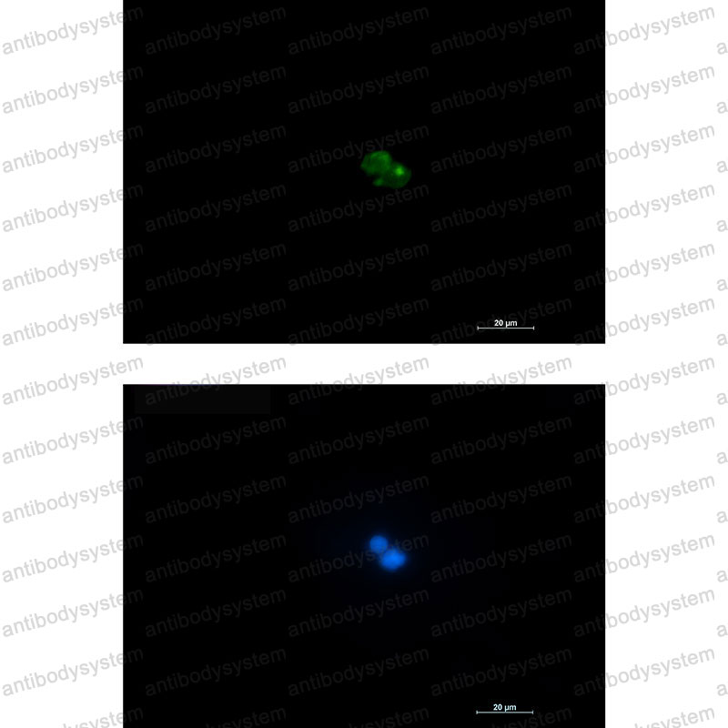 Anti-CD7 Antibody (R1M14)