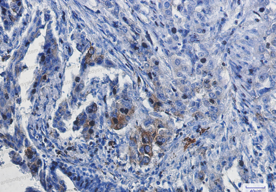 Anti-HMOX1 Antibody (R1M16)