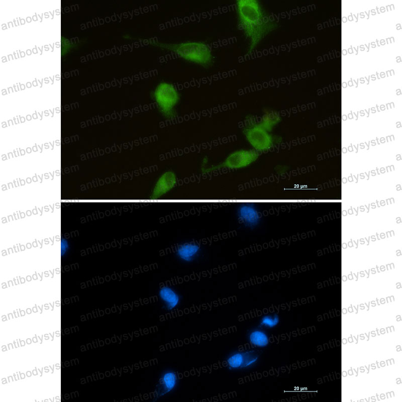 Anti-HMOX1 Antibody (R1M15)