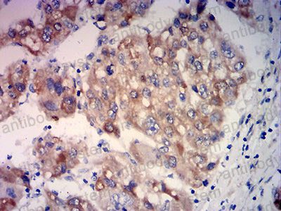 Immunohistochemical for Anti-HMOX1 Antibody (R3B68) ?>