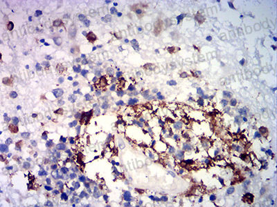Immunohistochemical for Anti-HMOX1 Antibody (R3B68) ?>