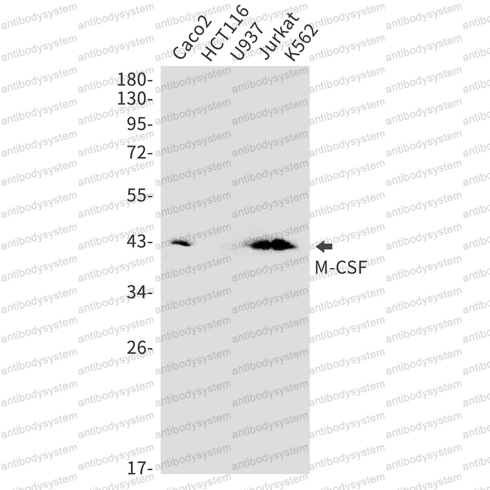 Anti-CSF1/M-CSF Antibody (R1M17)