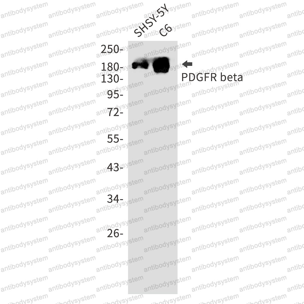 Anti-CD140b/PDGFRB Antibody (R1M20)