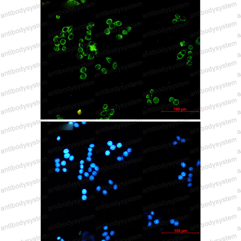 Anti-DLD Antibody (R1M22)