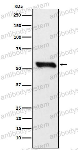 Anti-DLD Antibody (R1M21)