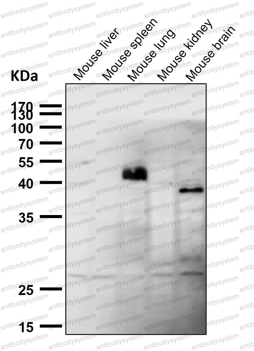 Anti-HOXC6 Antibody (R1M23)