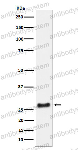 Anti-SNRPA1 Antibody (R1M25)