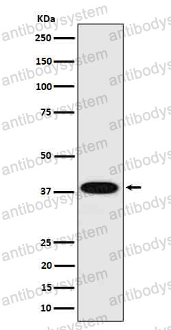 Anti-CTSH Antibody (R1M26)