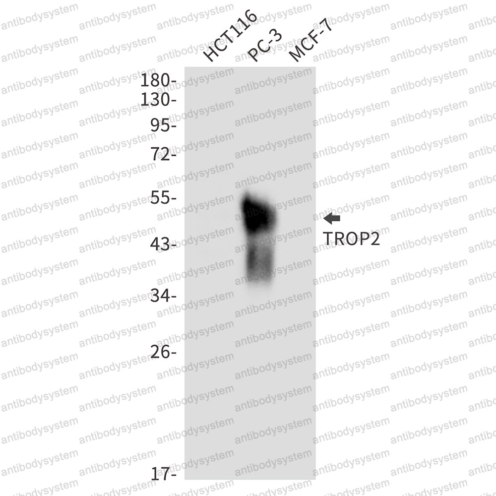 Anti-TACSTD2/TROP2 Antibody (R1M29)
