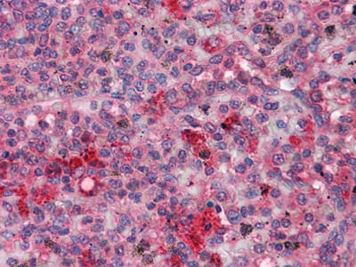 Immunohistochemical for Anti-FGR Antibody (R3B75) ?>