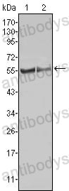 Western blot for Anti-FGR Antibody (R3B75) ?>