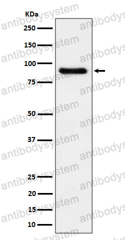 Anti-C1S Antibody (R1M30)
