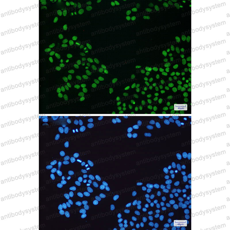 Anti-PARP1 Antibody (R1M32)