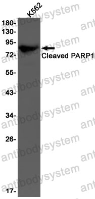 Anti-Cleaved-PARP1 Antibody (R1M31)