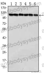 Western blot for Anti-PARP1 Antibody (R3B76) ?>