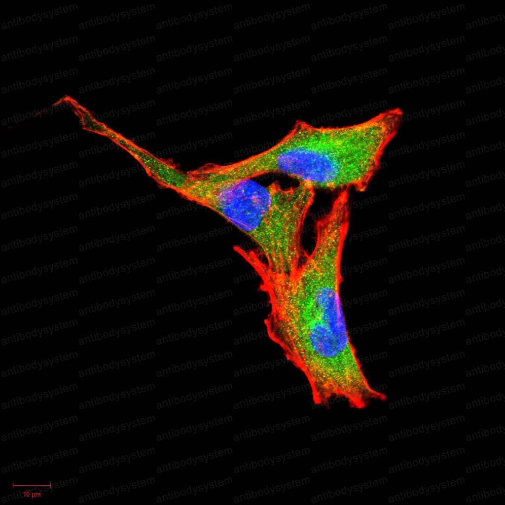 Immunofluorescence for Anti-CSF3/G-CSF Antibody (R3B79) ?>