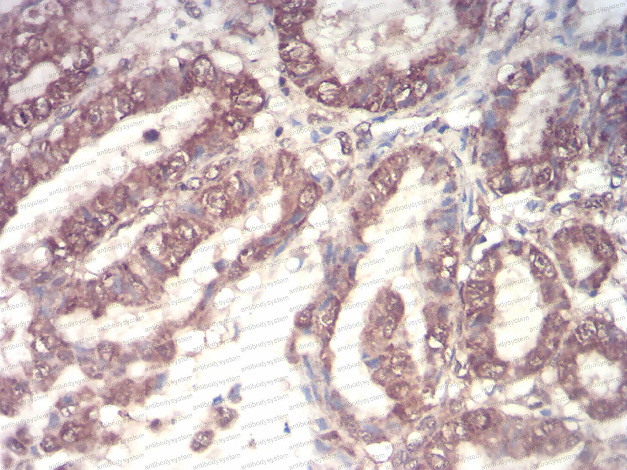 Immunohistochemical for Anti-CSF3/G-CSF Antibody (R3B79) ?>