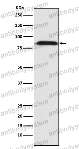 Anti-FURIN Antibody (R1M35)