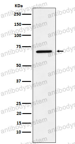 Anti-LTA4H Antibody (R1M36)