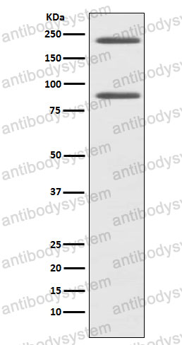 Anti-C4A Antibody (R1M38)