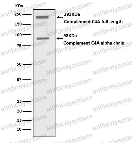 Anti-C4A Antibody (R1M39)