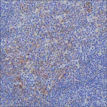 Immunohistochemical for Anti-C4A Antibody (R3B85) ?>
