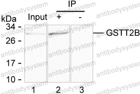 Immunoprecipitation for Anti-GSTT2B Antibody (R3B88) ?>