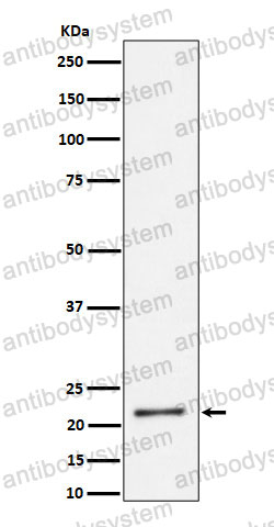 Anti-K27-linkage Specific Ubiquitin Antibody (R1B88)