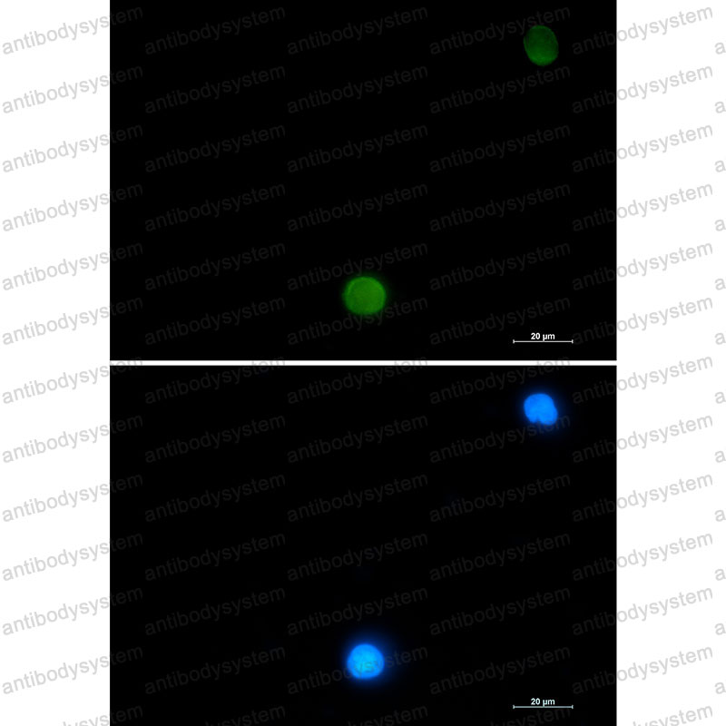 Anti-UBB Antibody (R1M42)
