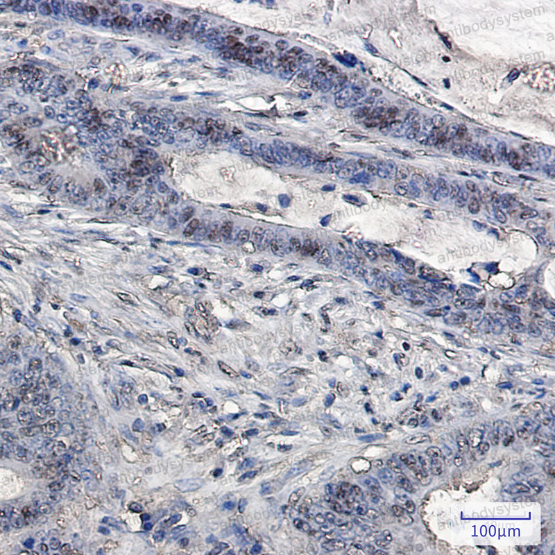 Anti-UBB Antibody (R1M43)