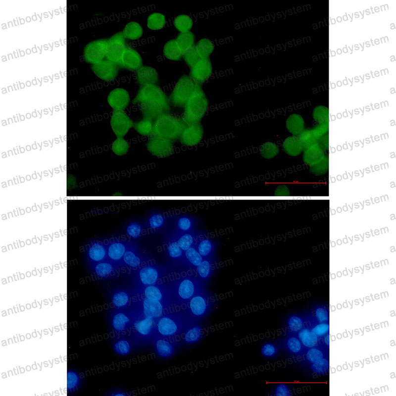 Anti-UBB Antibody (R1M44)