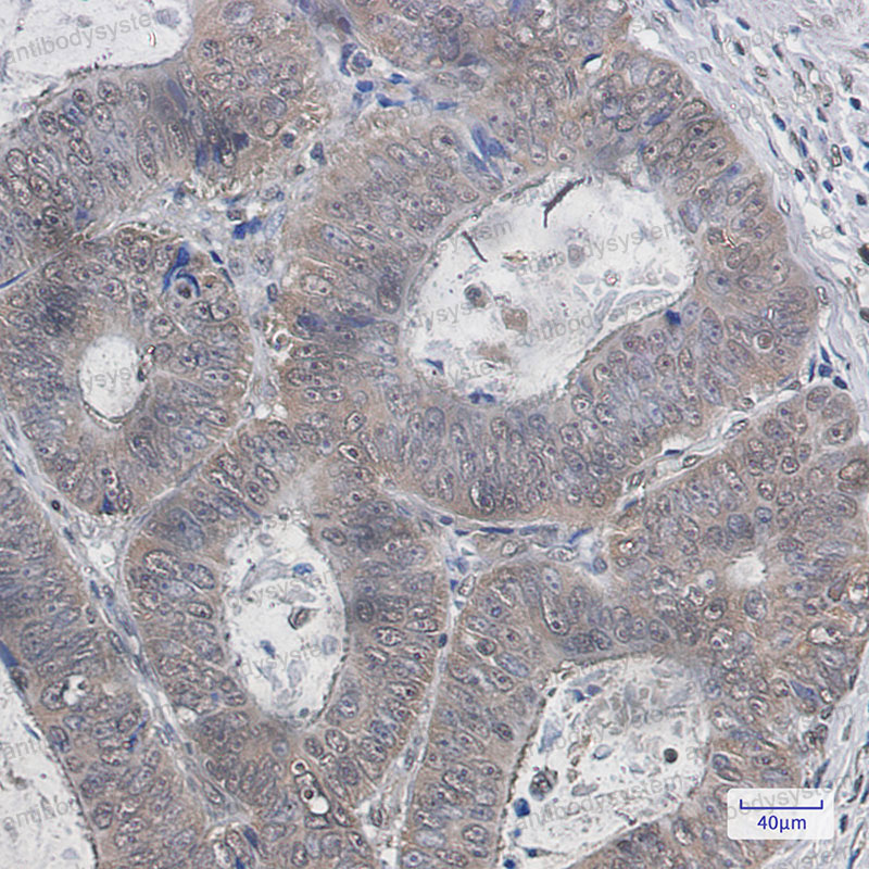 Anti-UBB Antibody (R1M41)