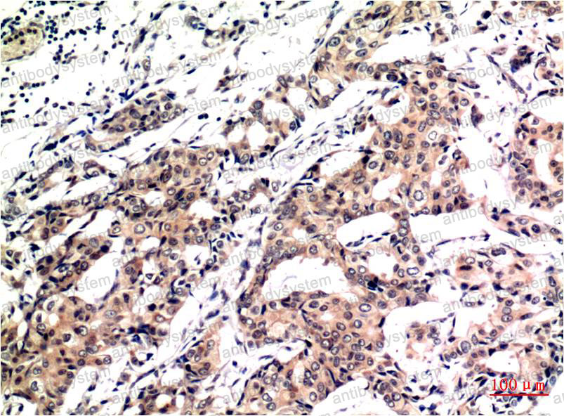 Immunohistochemical for Anti-UBB Antibody (R3B90) ?>