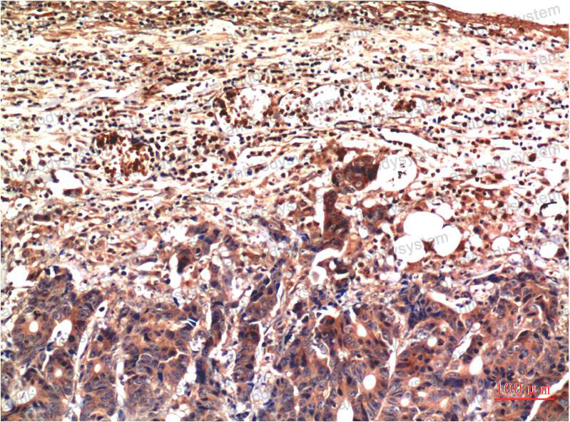 Immunohistochemical for Anti-UBB Antibody (R3B90) ?>
