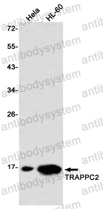 Anti-TRAPPC2 Antibody (R1M46)