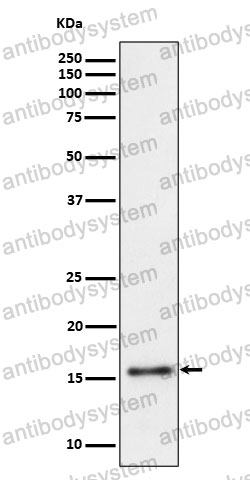 Anti-TRAPPC2 Antibody (R1M45)