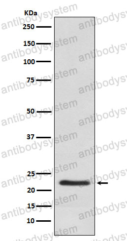 Anti-CSH1 Antibody (R1M48)