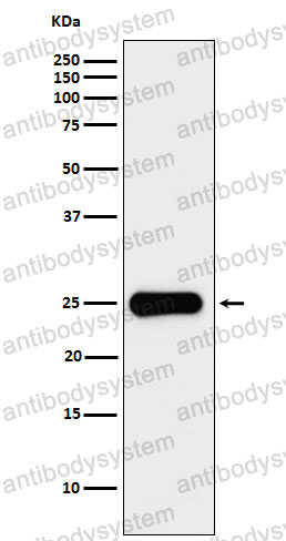 Anti-CSH1 Antibody (R1M47)