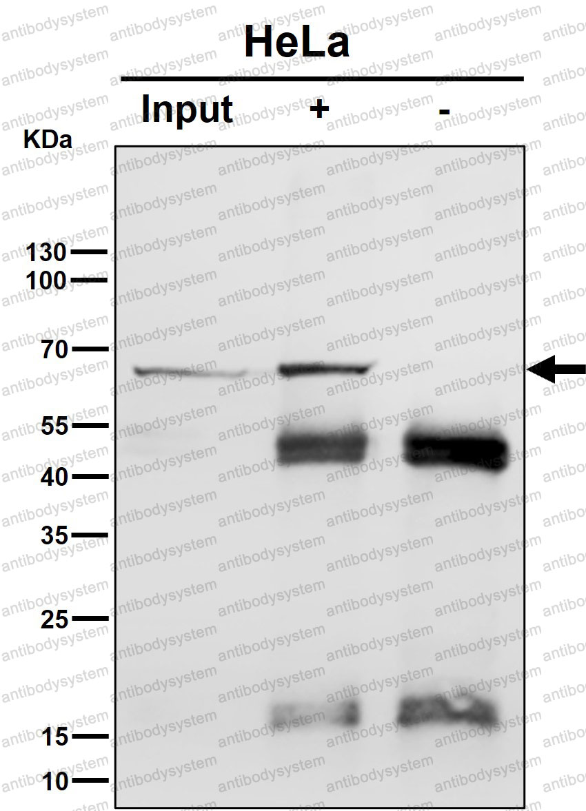 Anti-HSP70 Antibody (R1M49)