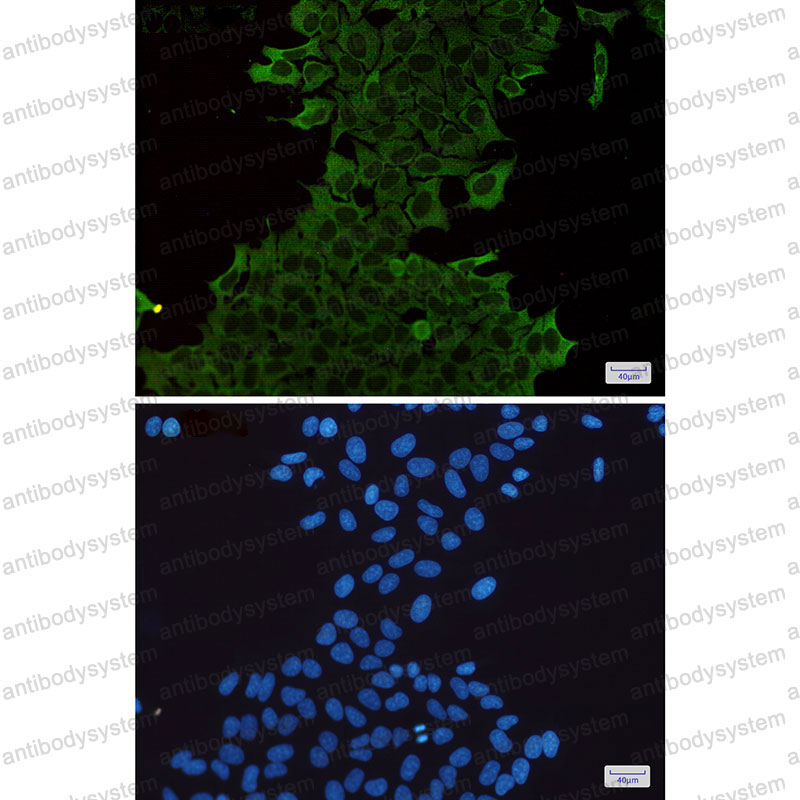 Anti-HSPA1A Antibody (R1M50)