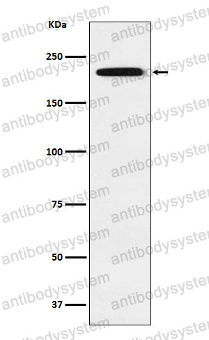 Anti-GLI3 Antibody (R1M54)