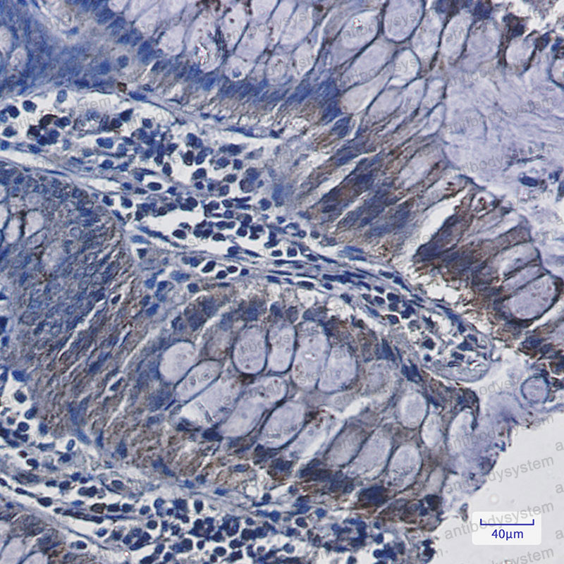 Anti-FDX1 Antibody (R1M57)