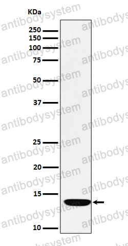 Anti-FDX1/ADX Antibody (R1M56)