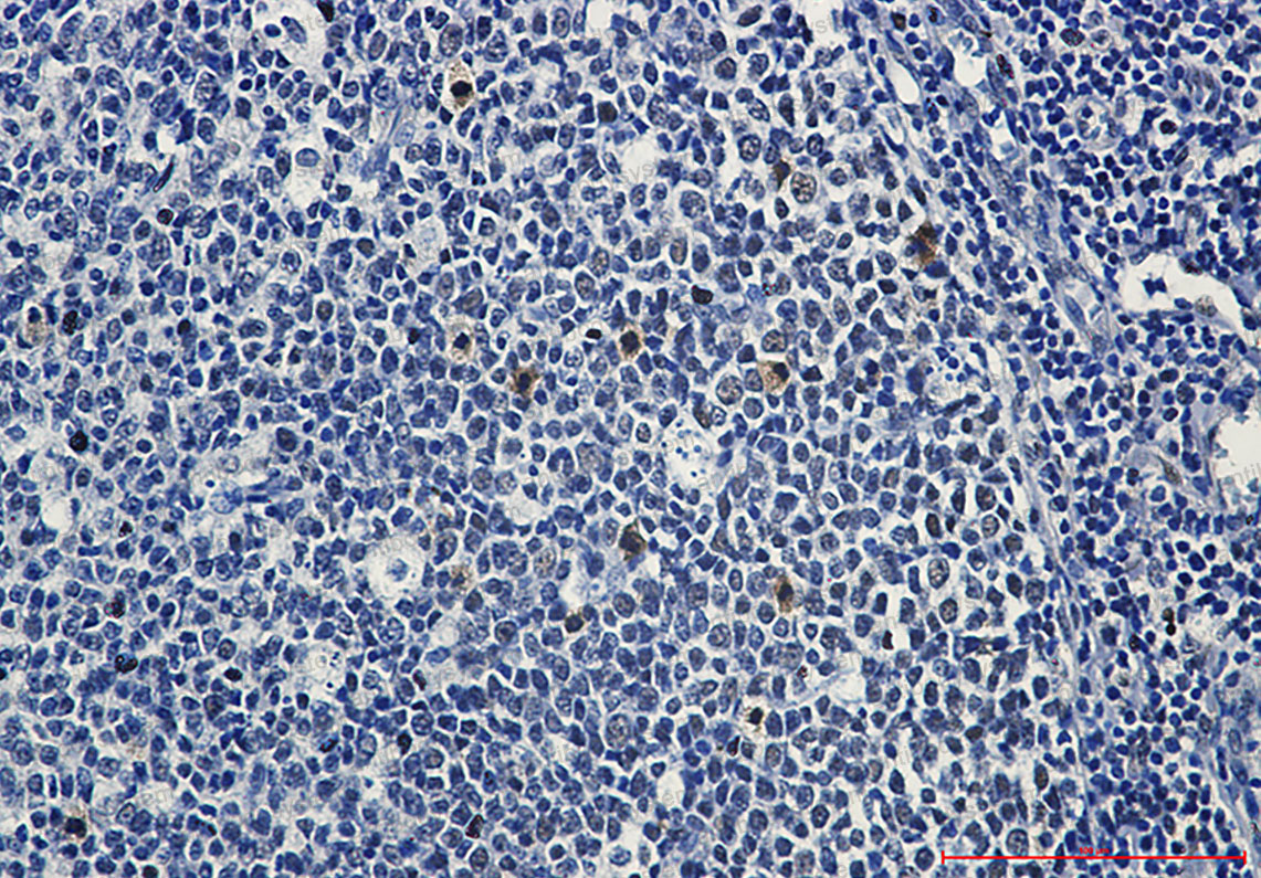 Anti-Phospho-c Myb (Ser11) Antibody (R1M59)