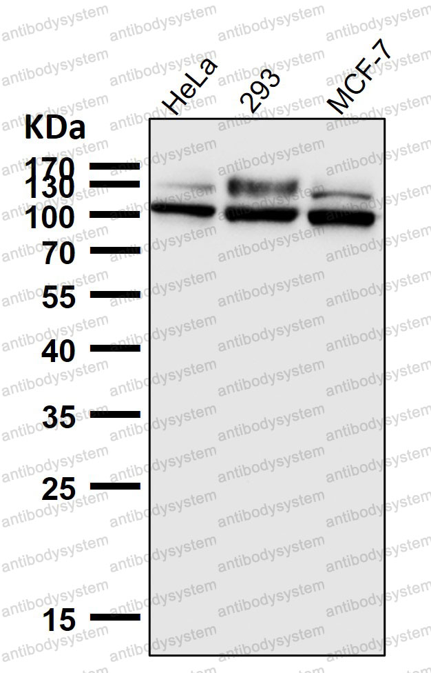 Anti-GAA/Aglucosidase alfa Antibody (R1M60)